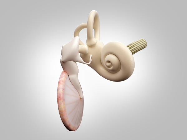 Hipoacusia infantil: Implantes de conducción ósea, de oído medio y de tronco cerebral